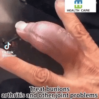 Bee venom  crema veneno de abeja