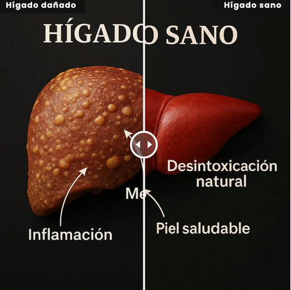 LIVER CLEANSE & DETOX