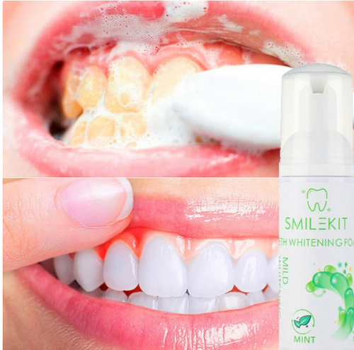 Espuma blanqueadora Dental